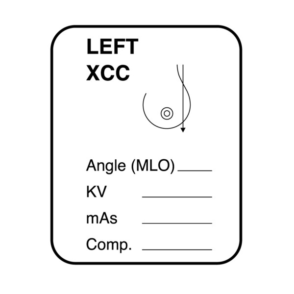 Nevs Mammography Labels - Left XCC 1-1/4" x 1" XM-1 - main